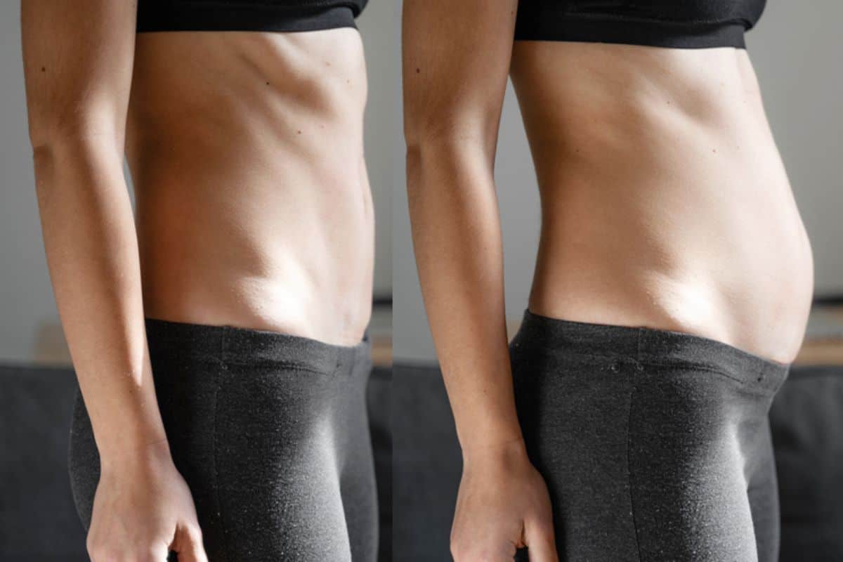 How long does diastasis recti take to improve West Drayton?