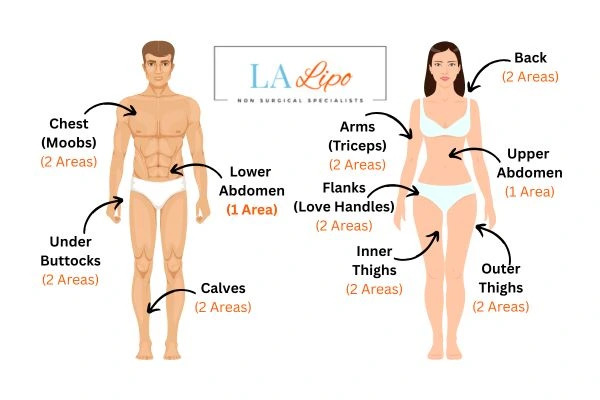 LA LIPO Cryolipolysis Areas West Drayton