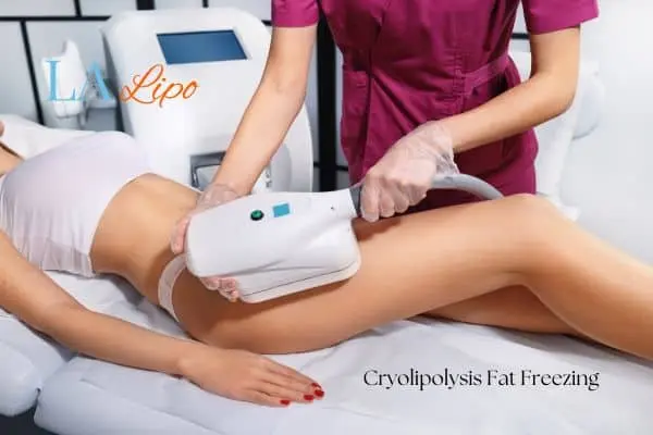 Woman receiving coolsculpting West Drayton treatment on her thighs