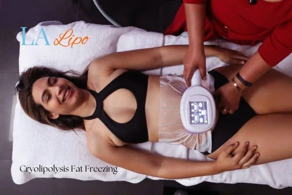 woman getting cryolipolysis West Drayton