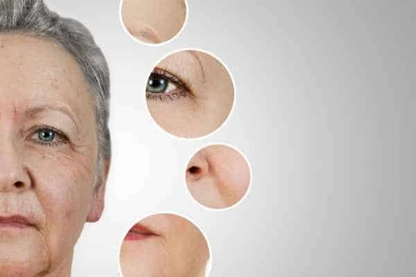 HIFU Facelift West Drayton from LA LIPO