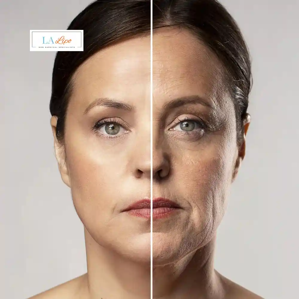 How Can You Tell If Non-Surgical Skin Tightening Is Right for You West Drayton?
