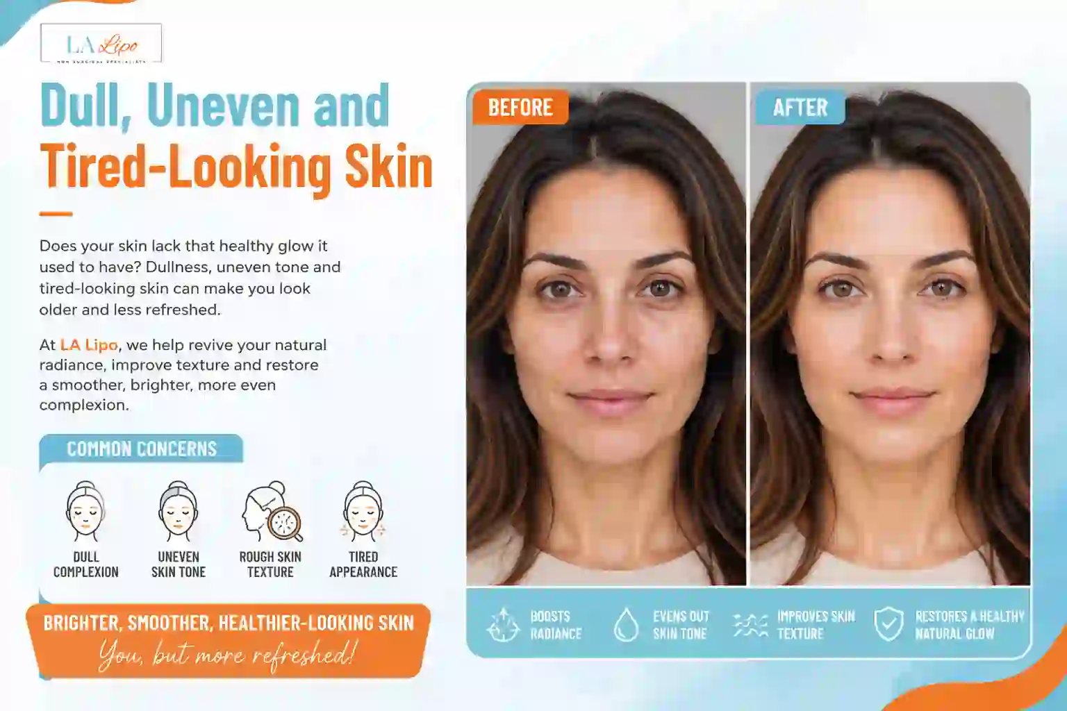 Sign #5: Dull, Uneven and Tired-Looking Skin West Drayton