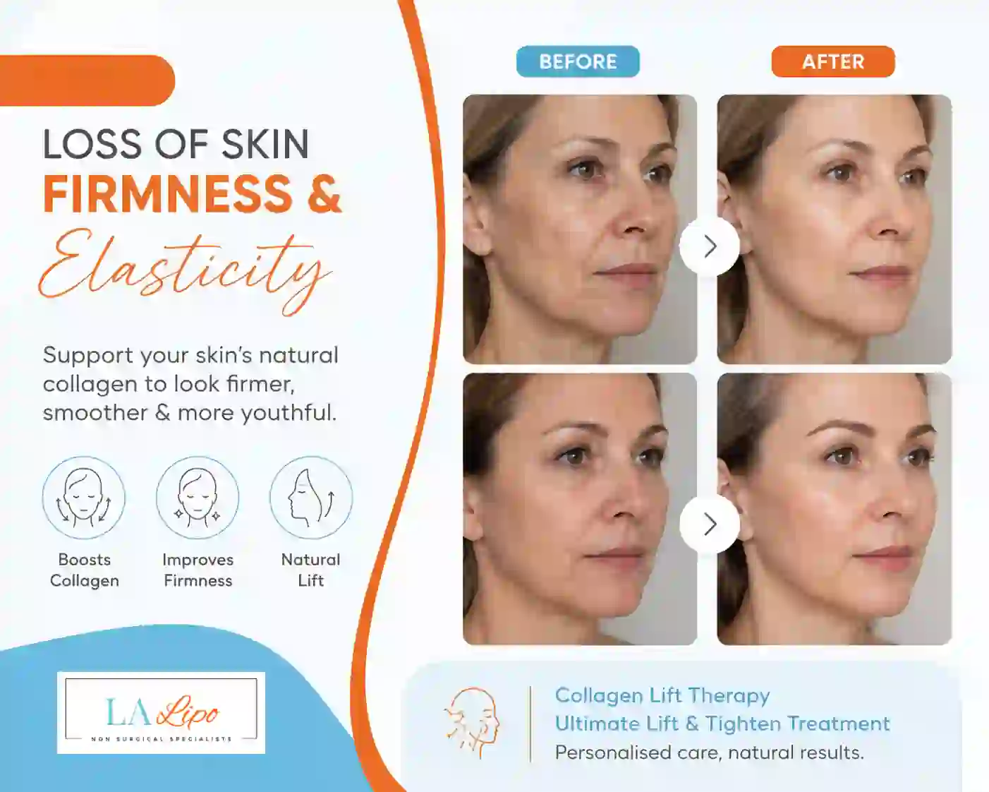 Sign #7: Loss of Skin Firmness and Elasticity West Drayton