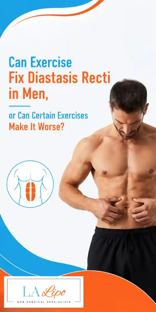 Can Exercise Fix Diastasis Recti in Men, or Can Certain Exercises Make It Worse West Drayton?