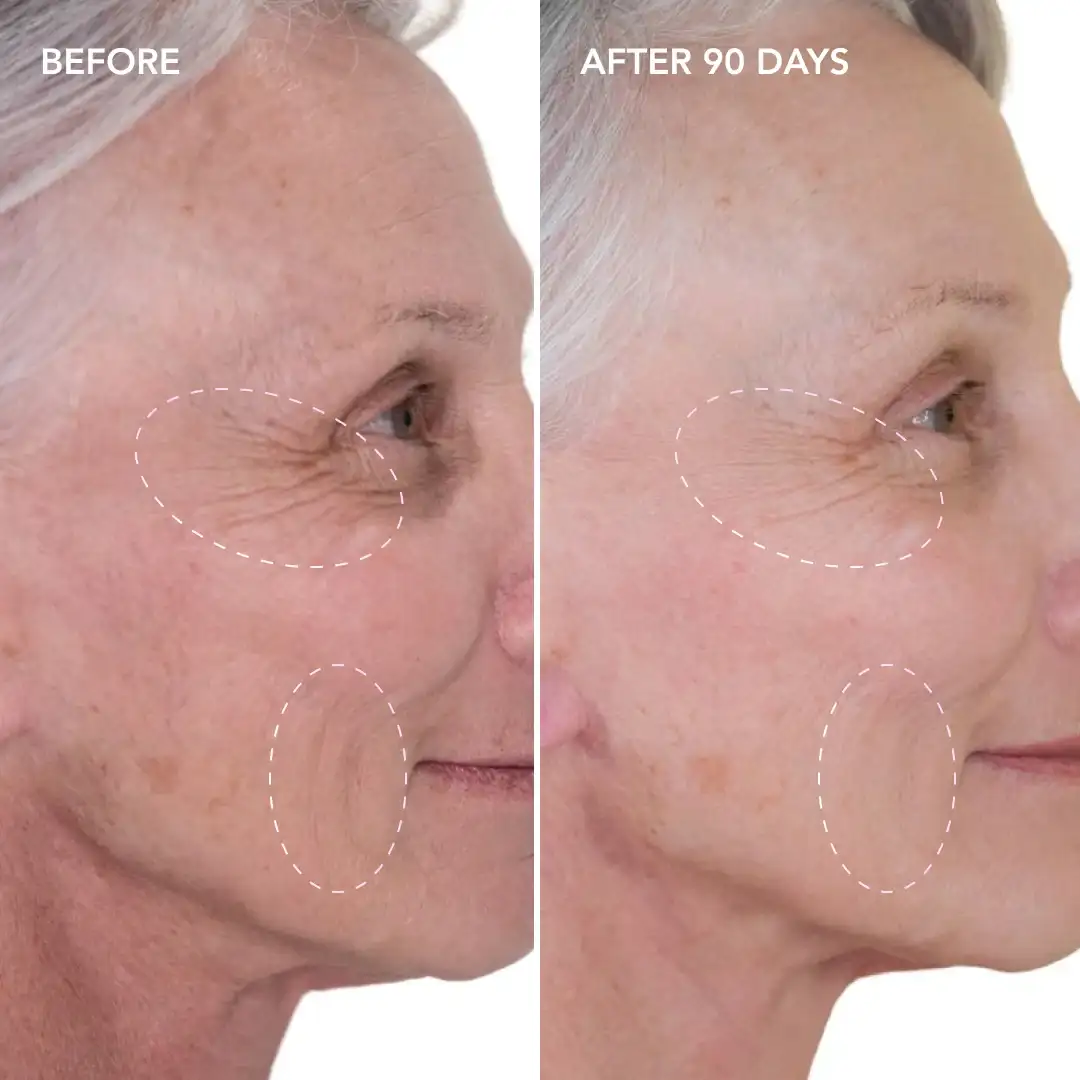 When will you see results West Drayton